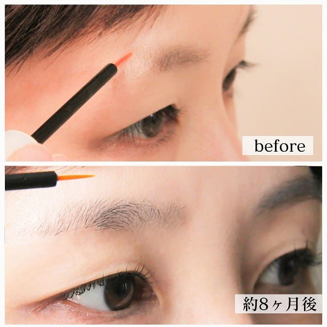 【soaddicted】Brow addict(ブロウアディクト)使用前と、使用開始8か月後の様子
