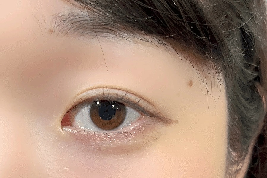 アンドヘルシー ビフォア