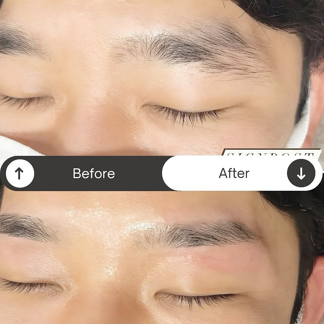 メンズアイブロウのビフォーアフター｜清潔感のある男性眉の変化｜サインポスト